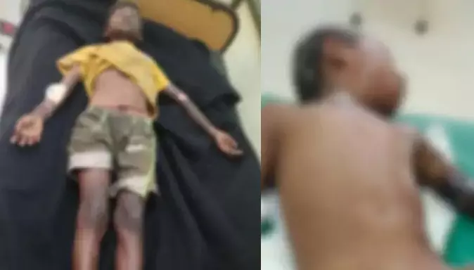 અંકલેશ્વર : સારંગપુર ખાતે મારુતિધામ 2માં વીજ શોર્ટ લાગતા બે બાળકો ગંભીર રીતે દાઝ્યા, સારવાર હેઠળ ખસેડાયા