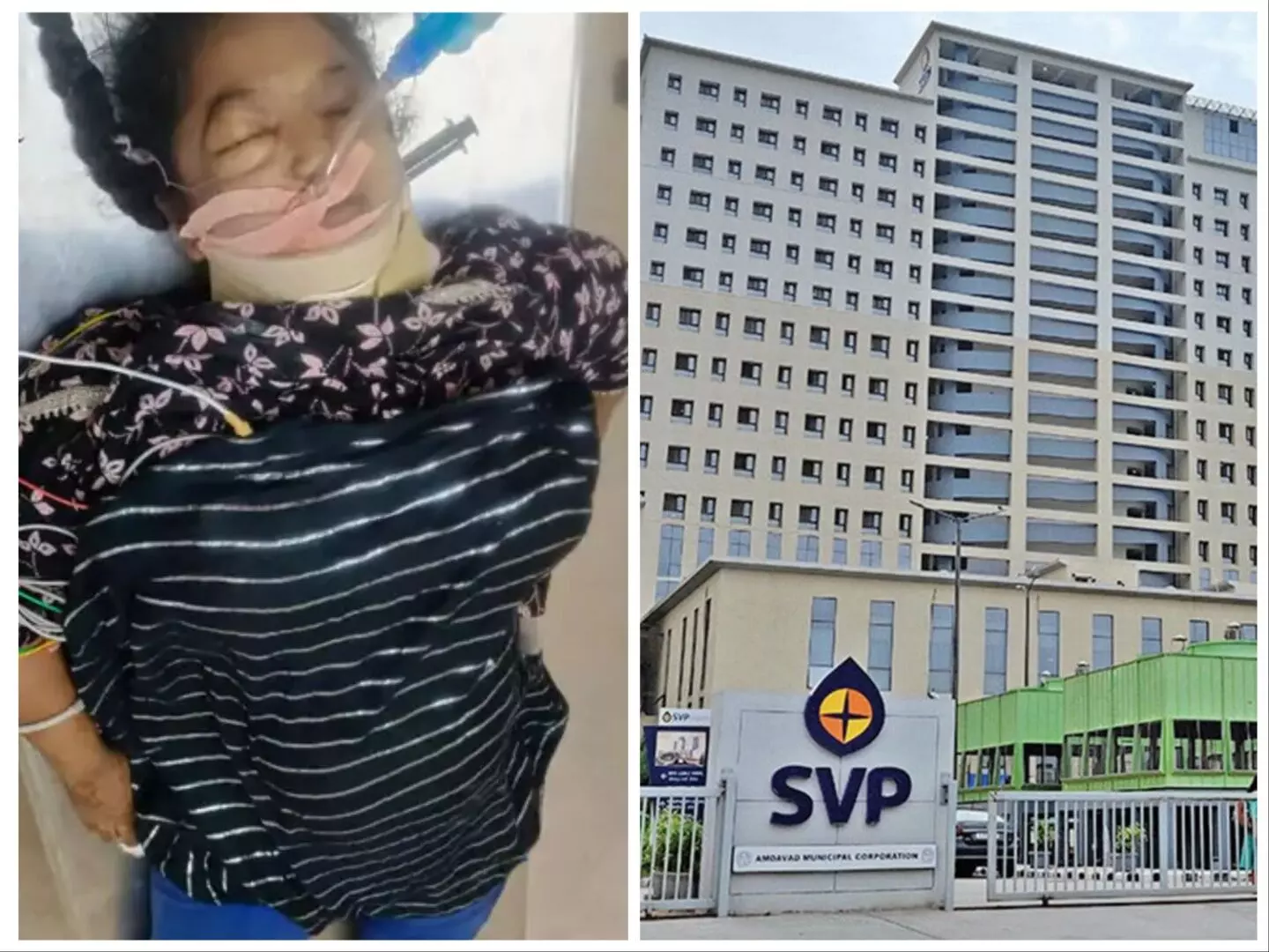 અમદાવાદ:SVP હોસ્પિટલમાં યુવતીએ  12 માળેથી મોતની છલાંગ લગાવી કર્યો આપઘાત