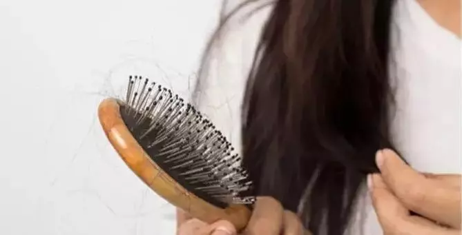 શિયાળાના ઠંડા પવનને કારણે વાળની સમસ્યા વધારે થાય છે, તો સમસ્યાથી રાહત મેળવવા આ પદ્ધતિ રાખો સંભાળ