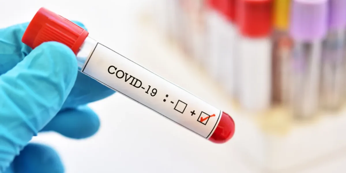 COVID-19: ગુજરાતમાં છેલ્લા 24 કલાકમાં કોરોના સંક્રમણનાં નોંધાયા 954 કેસ