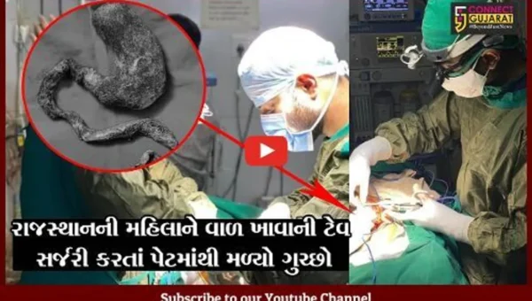બનાસકાંઠા : મહિલા 20 વર્ષથી પોતાના જ વાળ તોડી ખાતી હતી, સર્જરી કરતાં પેટમાંથી મળ્યો ગુચ્છો