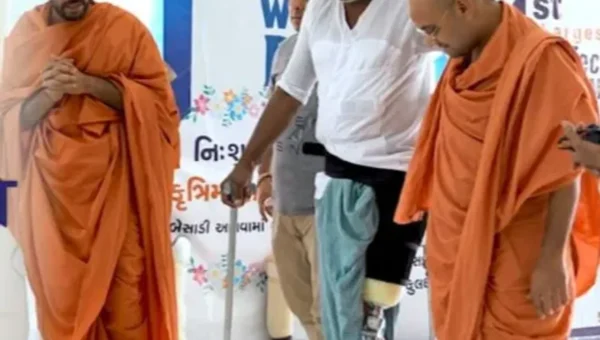 સુરત : નિ:શુલ્ક કૃત્રિમ હાથ-પગ બેસાડી આપવા માટેના કેમ્પનું સ્વામિનારાયણ ગોકુલધામ-નાર દ્વારા આયોજન