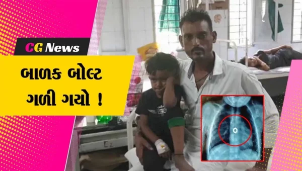 સુરત: વાલીઓ માટે લાલબતી સમાન ઘટના ! ઘરમાં રમતી વેળાએ બાળક બોલ્ટ ગળી ગયો
