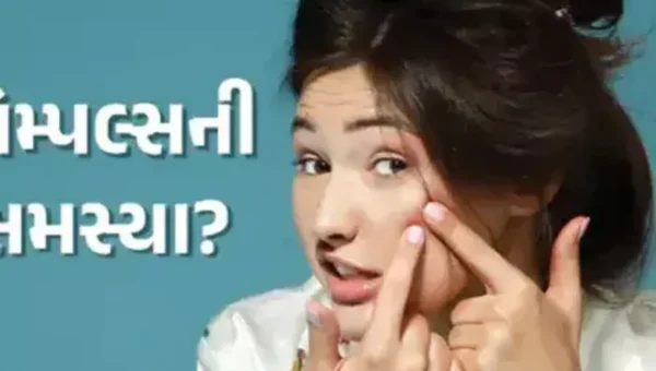 પિંપલ્સ થવાનું મુખ્ય કારણ છે તૈલી ત્વચા, જાણો ત્વચાની સંભાળ રાખવાની સાચી રીત….