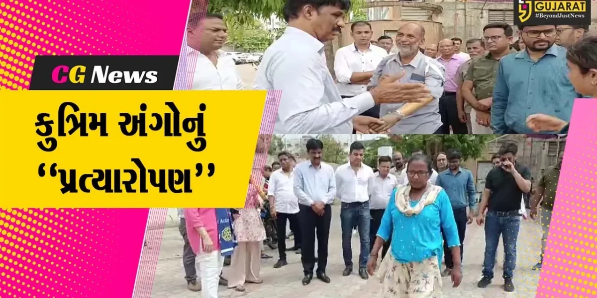 રોટરી ક્લબ ઓફ ભરૂચ દ્વારા 50 દિવ્યાંગ લાભાર્થીઓને કુત્રિમ અંગોનું પ્રત્યારોપણ કરાયું