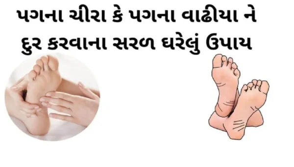 પગના વાઢિયાથી છો પરેશાન?, તો આ બાબતો ધ્યાનમાં લો…