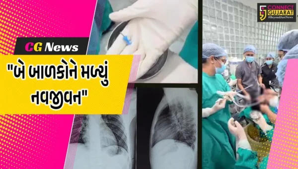 વડોદરા :  સયાજી હોસ્પિટલમાં બે બાળકોની ENT વિભાગે સફળ સર્જરી કરી,પેપર પિન અને સિક્કો સર્જરી કરી બહાર કાઢવામાં આવ્યા