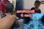 સુરતમાં કાળજું કંપાવતી ઘટના : બાળકના ગળામાં સળિયો ઘૂસ્યો, તો દોઢ વર્ષના માસૂમે સેફ્ટી પિન ગળી
