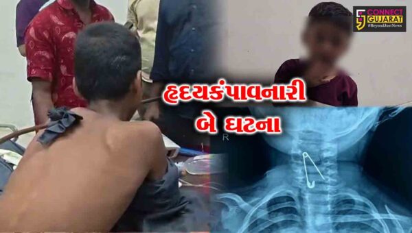 સુરતમાં કાળજું કંપાવતી ઘટના : બાળકના ગળામાં સળિયો ઘૂસ્યો, તો દોઢ વર્ષના માસૂમે સેફ્ટી પિન ગળી